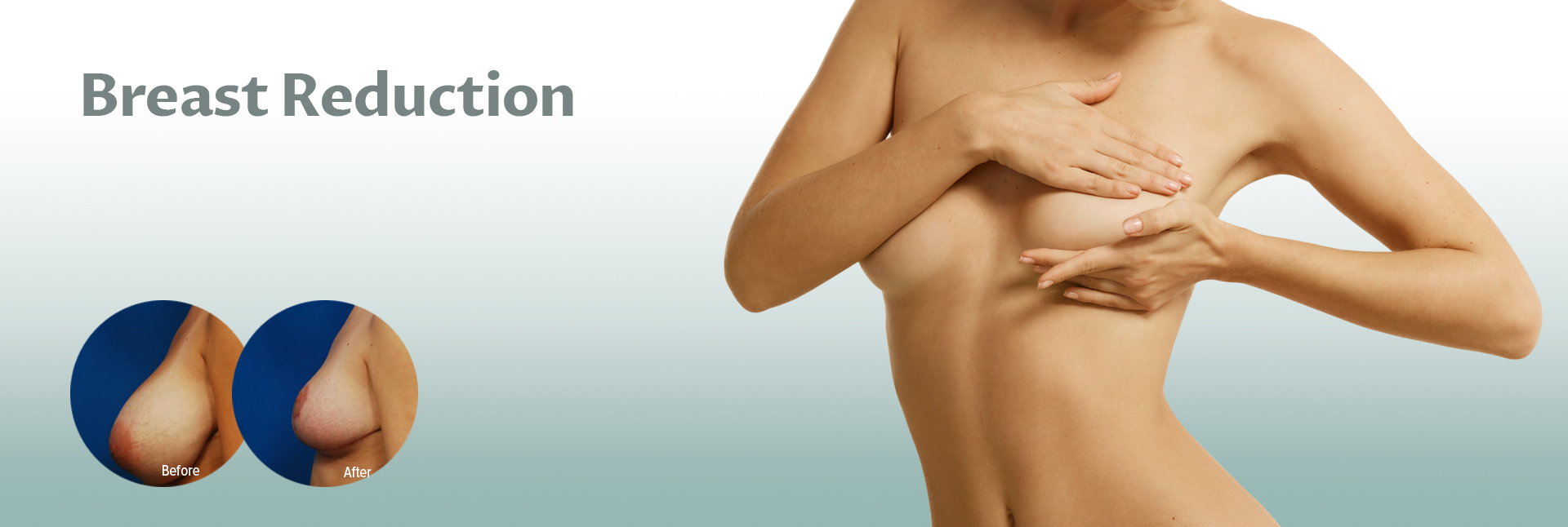 Breast Lift  Mastopexy & Breast Uplift London, UK Prices & Cost
