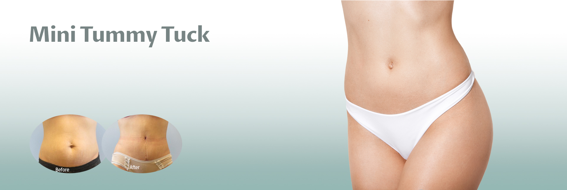 Liposuction / Mini Tummy Tuck  Otolaryngology & Facial Plastic